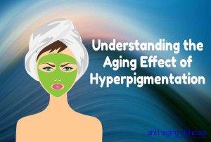 aging-effect-hyperpigmentation